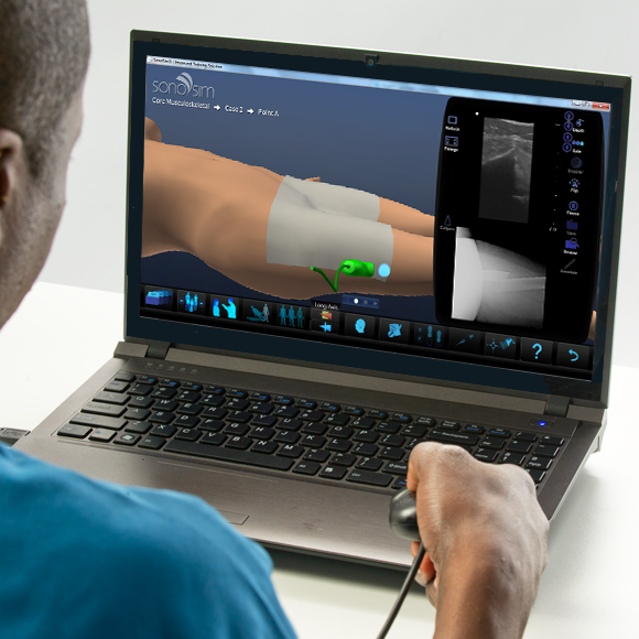 SonoSim Releases Comprehensive Musculoskeletal Ultrasound Training Package